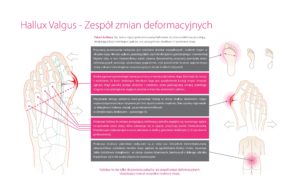manual haluksy opis zmian inna wersja