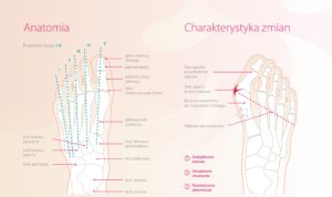 manual haluksy porownanie zdrowa haluks